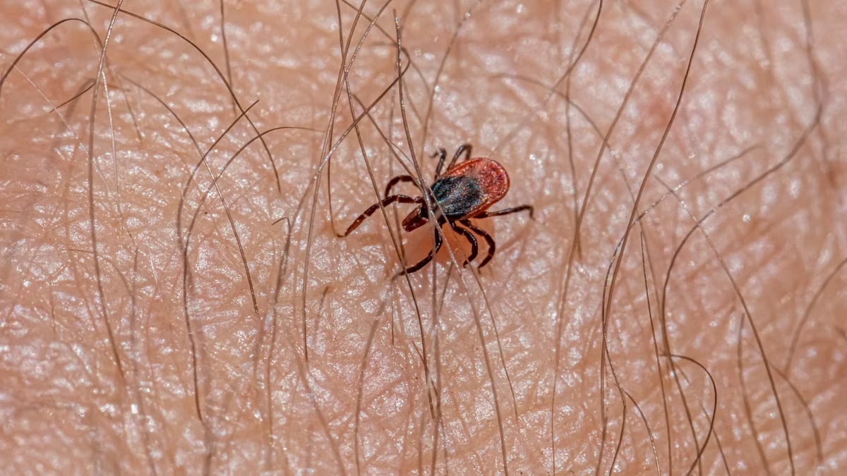 Macro view of a castor bean tick on human skin, highlighting tick's details.